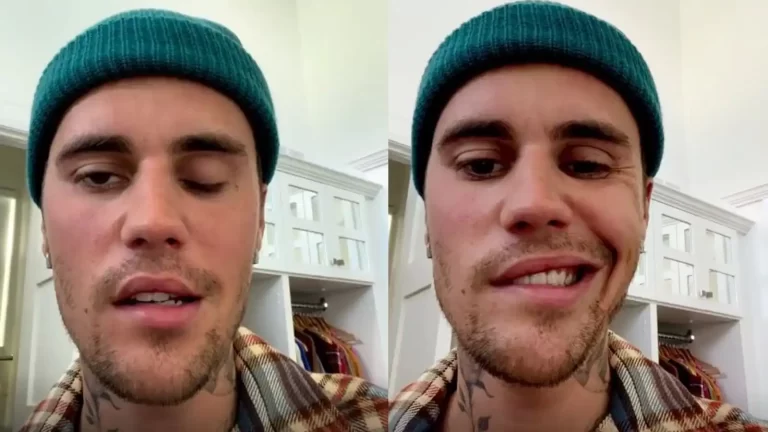 What is Ramsay Hunt Syndrome, which has left Justin Bieber with partial face paralysis
