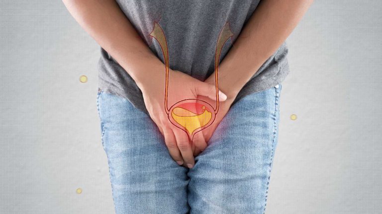 Suffer from overactive bladder syndrome? Its causes and treatment