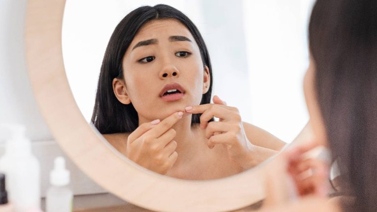 Know 8 ways to treat acne and clear your skin