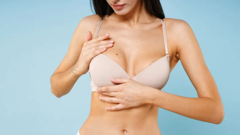 What can you do about underboob rash? Here are 7 tips