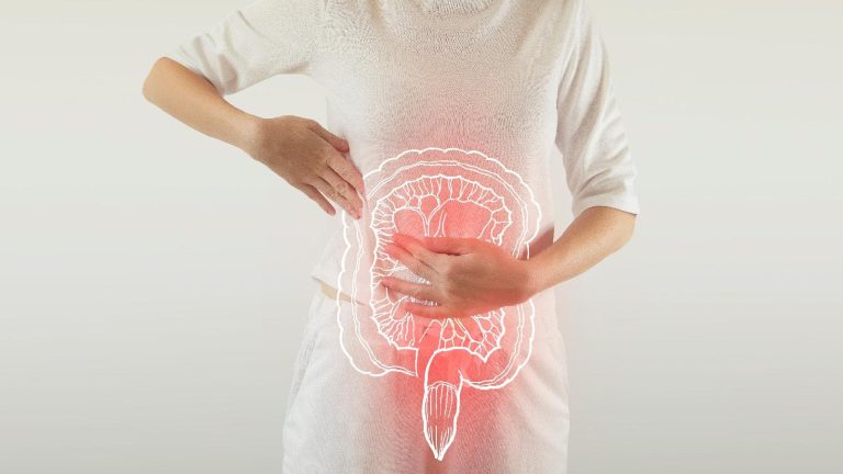 Irritable bowel syndrome: How to deal with IBS naturally