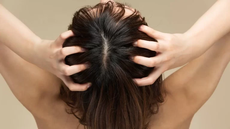 Hair oil: 4 conditions when you should avoid oiling your scalp