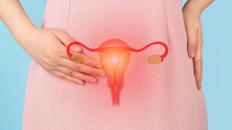 Self care for endometriosis: These tips can help you manage the condition