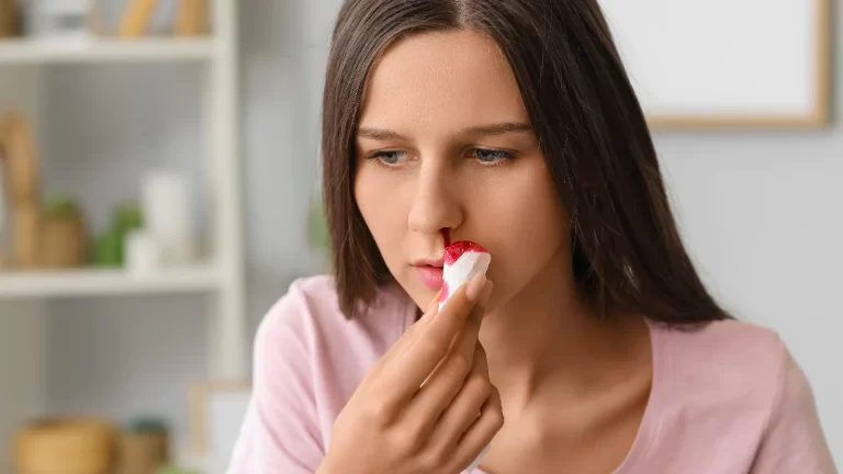 Know how to stop a nosebleed easily at home