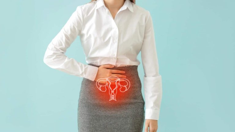 Endometriosis and irritable bowel syndrome: Is there a connection?