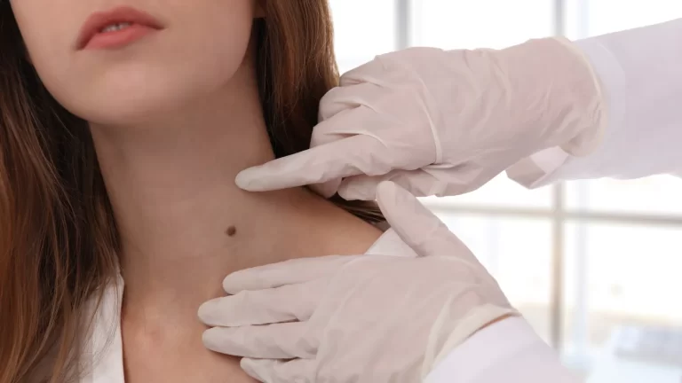 What are skin tags? Read on to find out its causes and treatment options