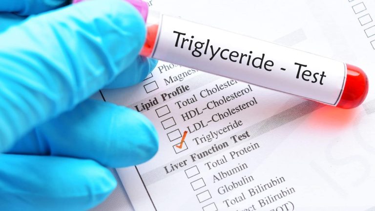 Risk factors of high triglycerides and 7 ways to control it