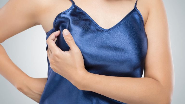 Bra chafing: Natural remedies to get rid of underboob rashes