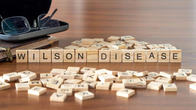Wilson’s disease: This rare disease damages your liver, brain, and more