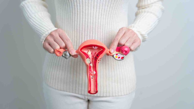 Do all uterine fibroids need removal? Know common fibroid myths
