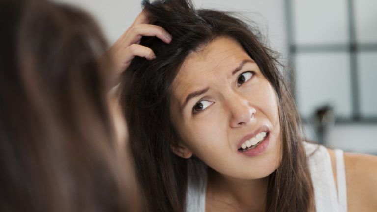 Dry scalp or dandruff: 4 ways to know the difference